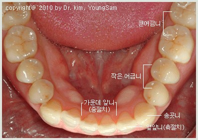 dentition2.jpg