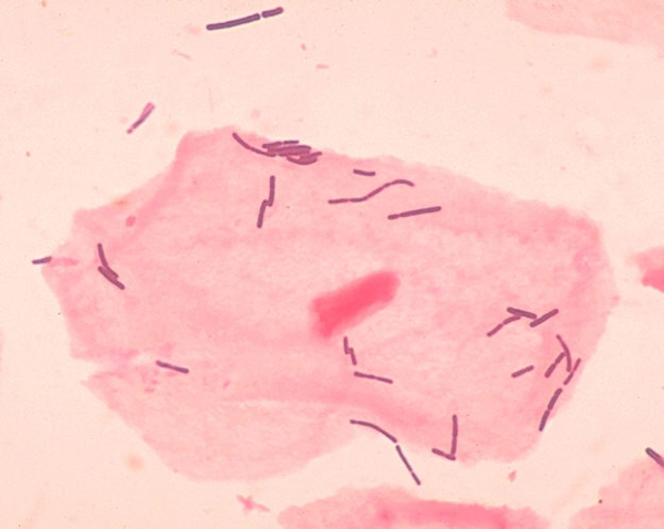 Lactobacillus_sp_01.png