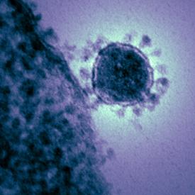 A colorized electron micrograph of the new coronavirus HCoV EMC  Credit  NIAID RML Beth Fischer.jpg