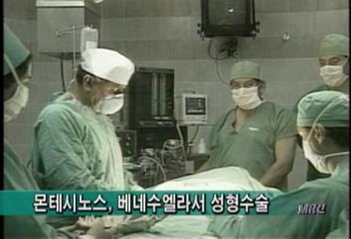 몬테시노스 성형수술.jpg