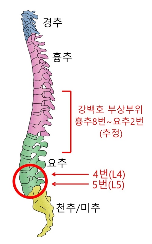 14-7-spondylolysis_lumbar.jpg