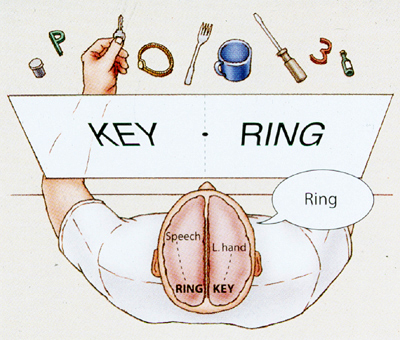 split-brain.jpg